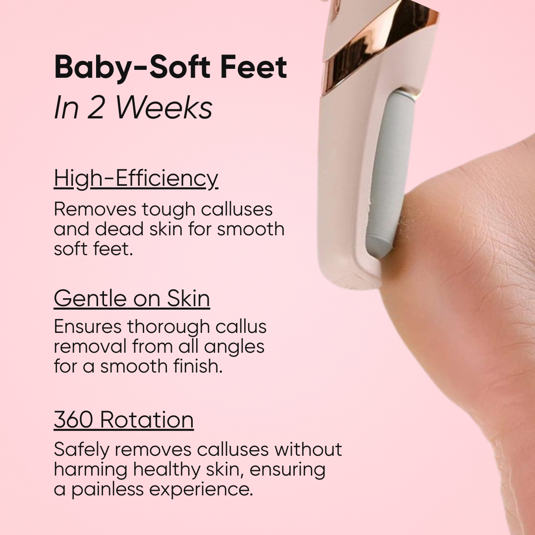 Venus Callus BeGone™ Roller Edition