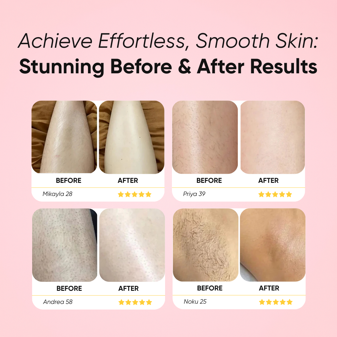 Venus™ Trimmer
